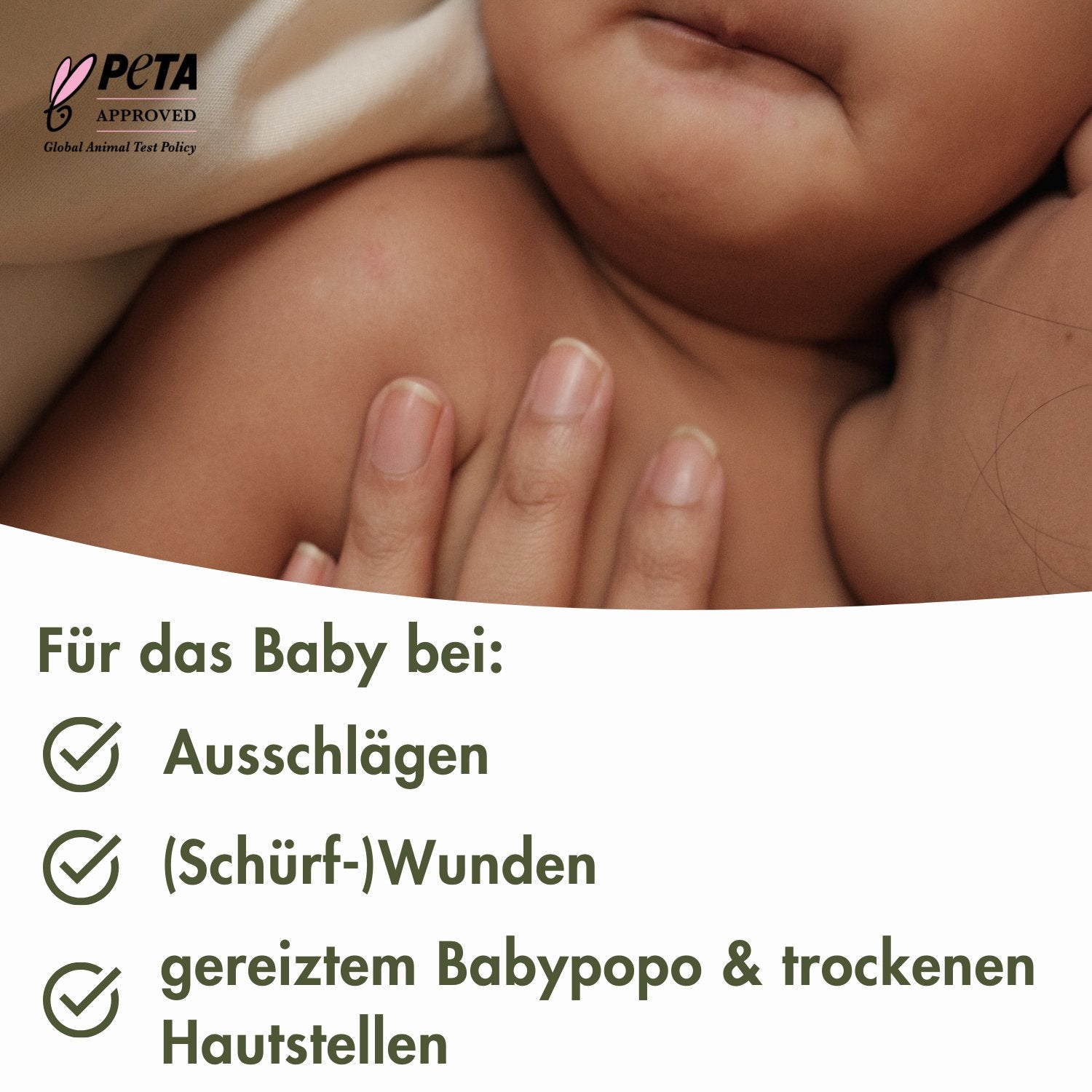 The Soothing Multi Balm - Brustwarzen - /Narben - /Wundschutzbalsam - MyClarella - für das Baby bei Ausschlägen, Wunden, Schürfwunden, gereiztem Babypo und trockenen Hautstellen